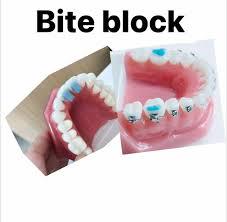 Does anyone have a deepbite? 