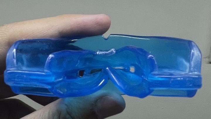 Lower Jaw shifted 