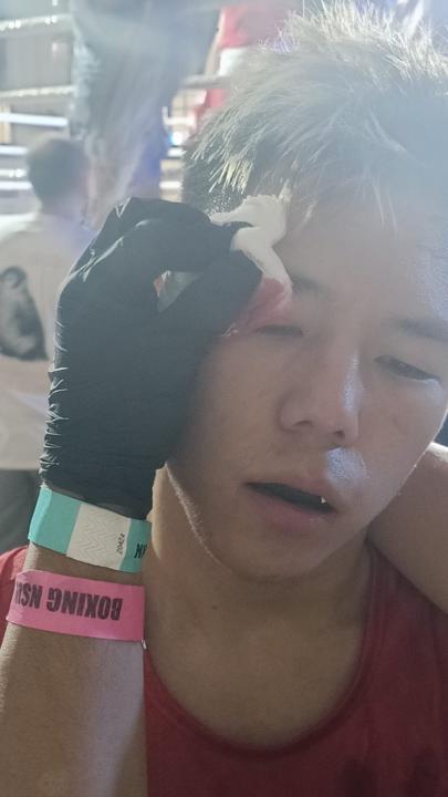 Day 5 and the fight results