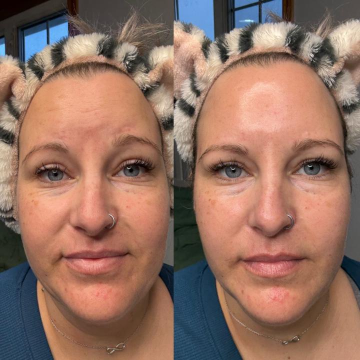 Collagen Mask Results are NO JOKE! 
