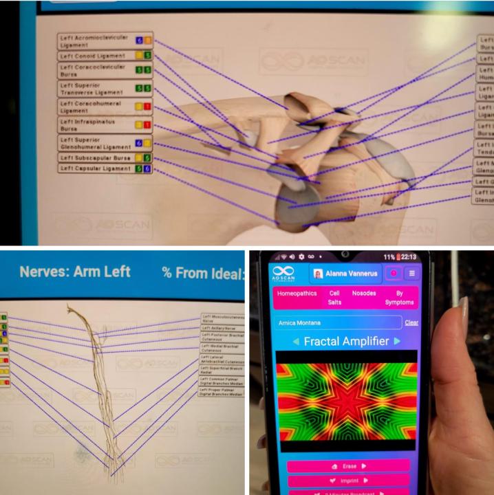 Shoulder Pain Relief ☺️
