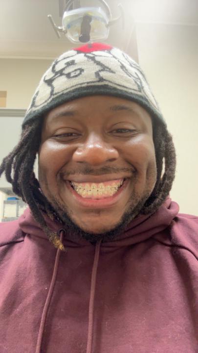 Anfernee Rone