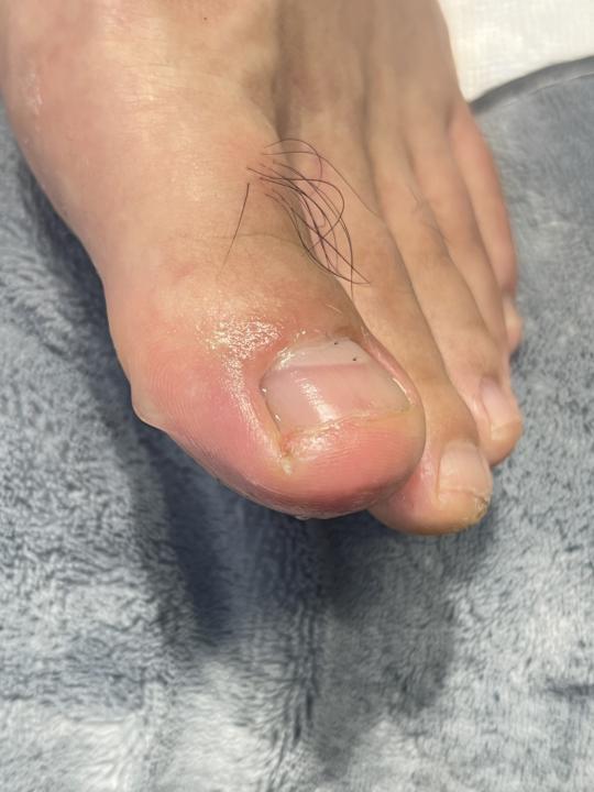 想請問傷口處理方式