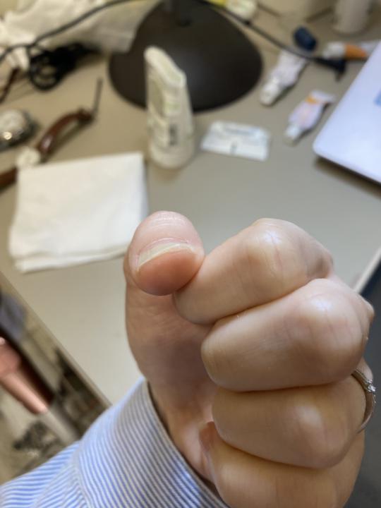 我這狀況，你們能做嗎？