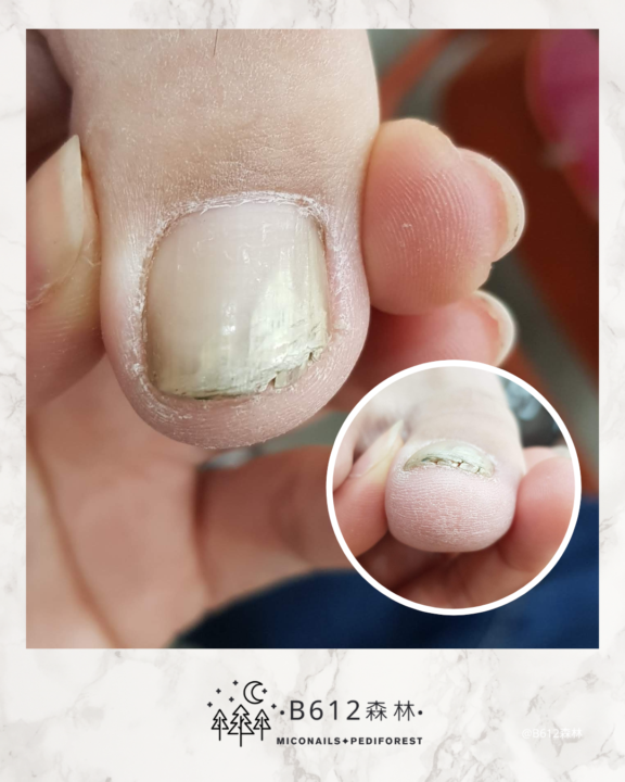 260304-案例投票討論練習
