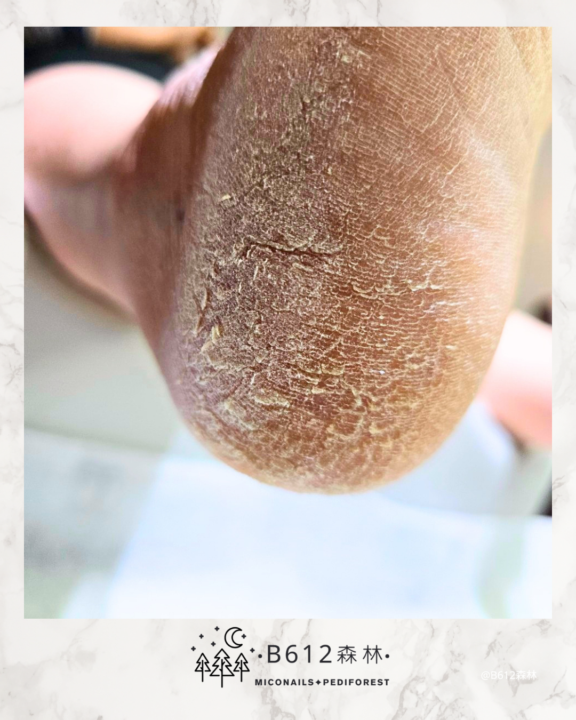 260408-案例投票討論練習