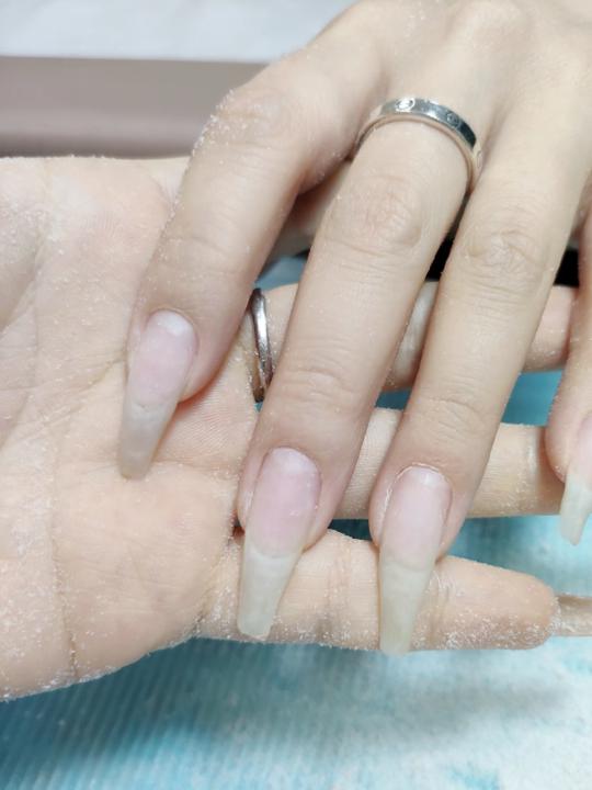 真指甲為什麼會內卷?