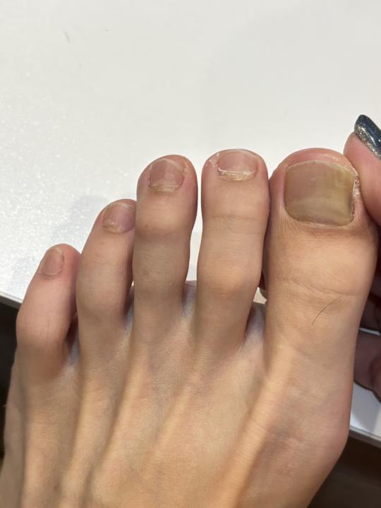 問題甲求解