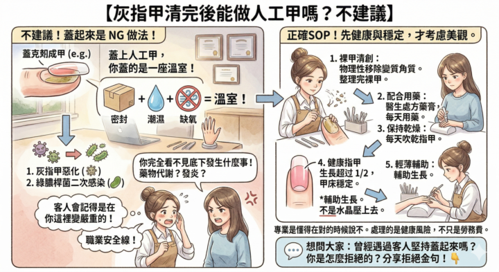 移除灰指甲後，能直接做人工甲嗎？