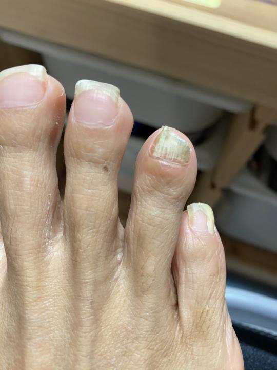 問題甲詢問