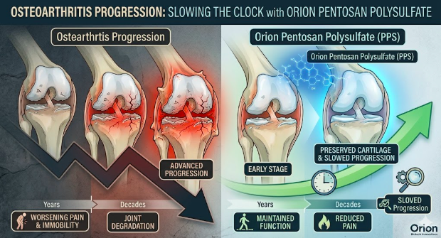 Osteoarthritis: I Stopped Waiting for My Joints to Fail and Started Researching Orion Pentosan Polysulfate