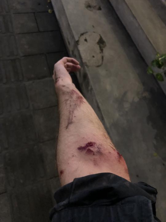 Raw Tribal Accident at Canggu Bali