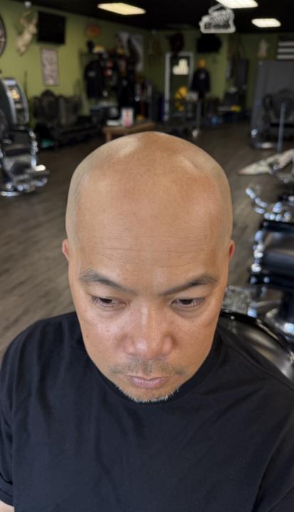 Before and After 