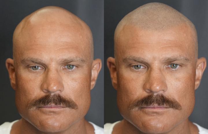 Before and after photo mock up 