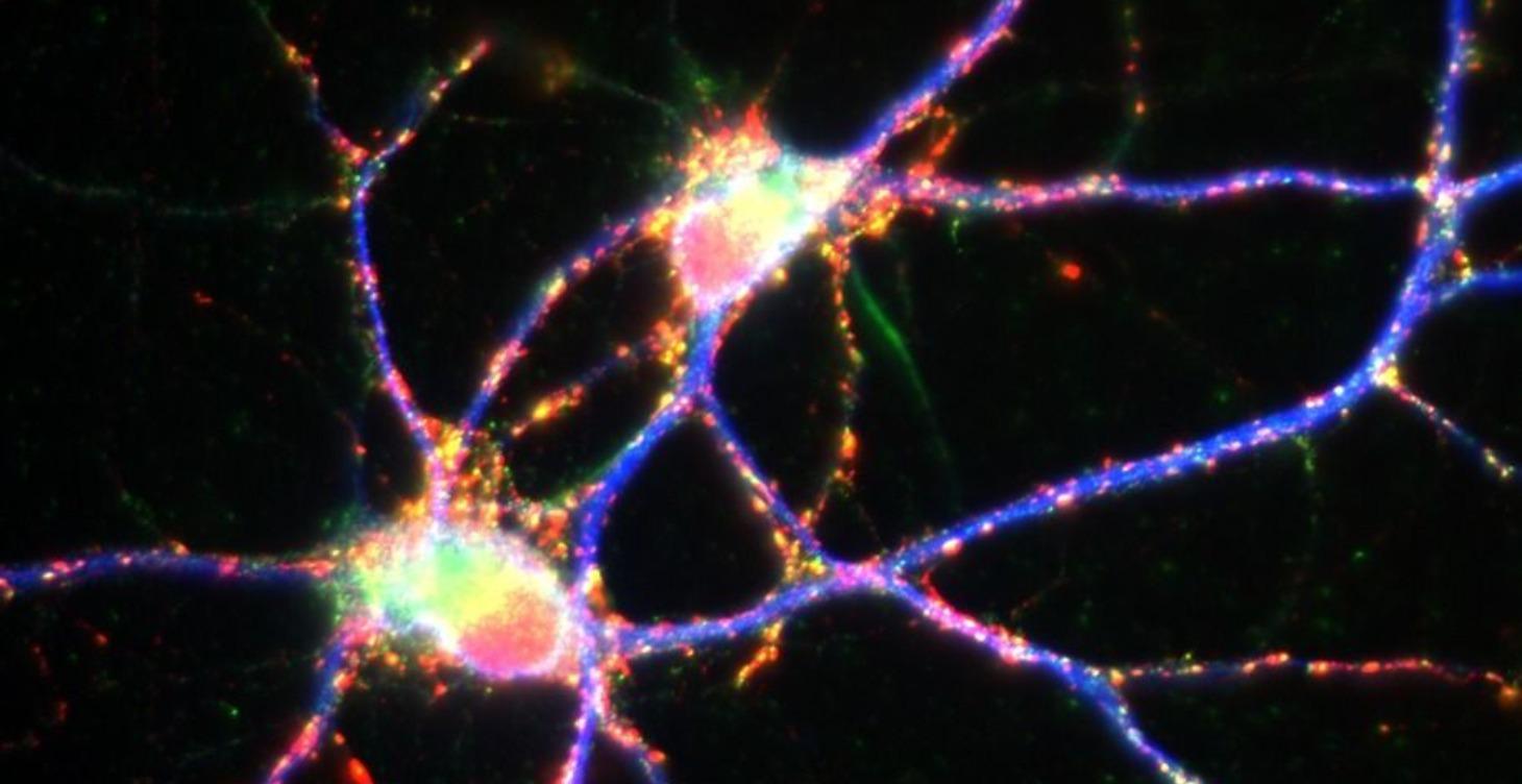 Nervous System Reset