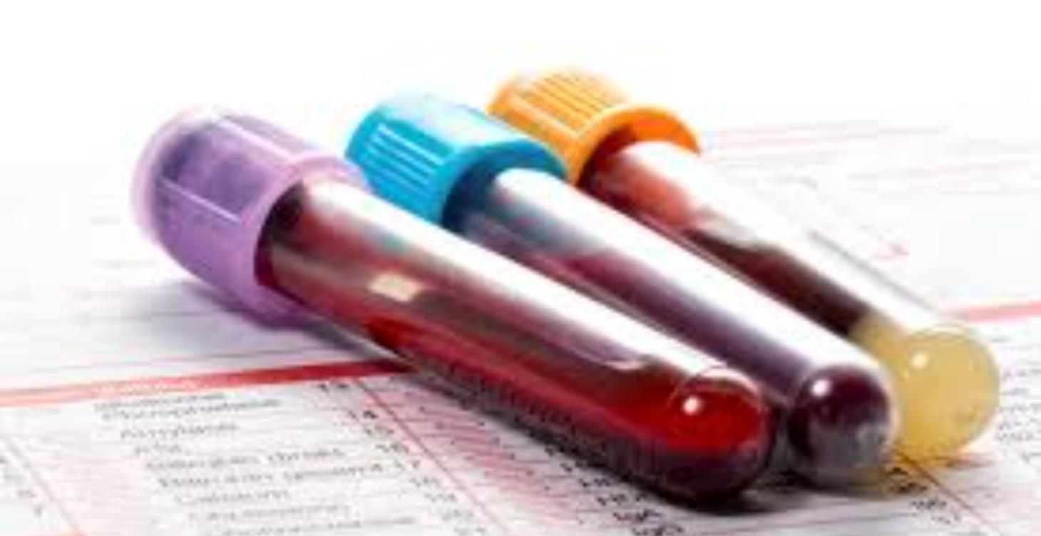 Bloodwork Patterns