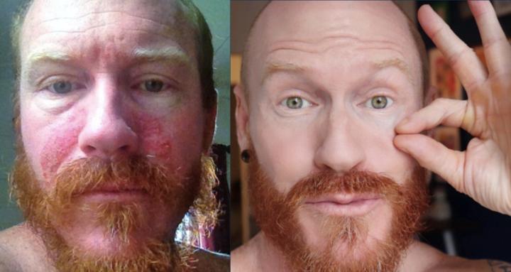 Restore Your Skin Elite