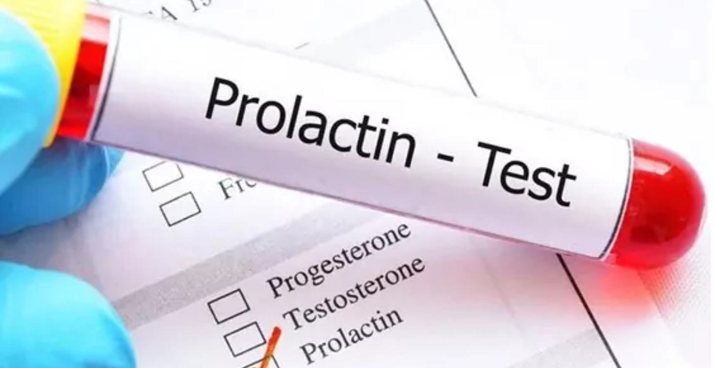 Пролактин 2025