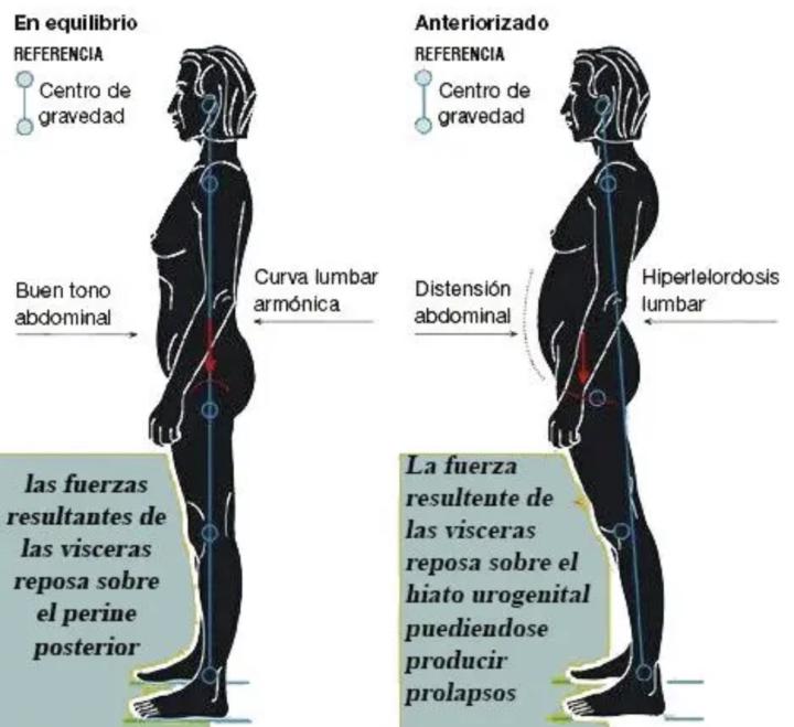 Presiones y postura ( Parte 2 )