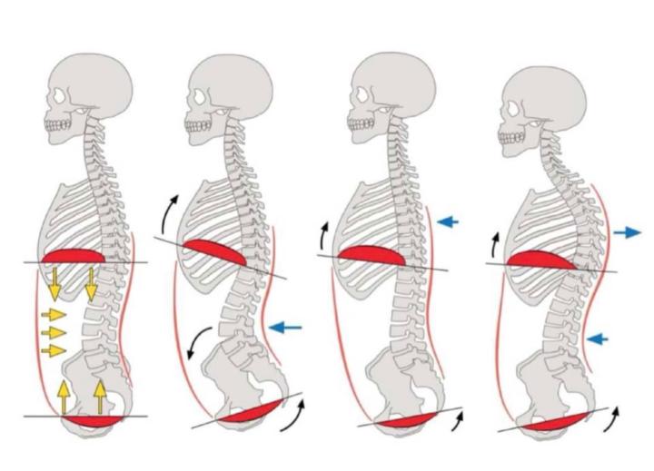 Presiones y postura ( Parte 1 )