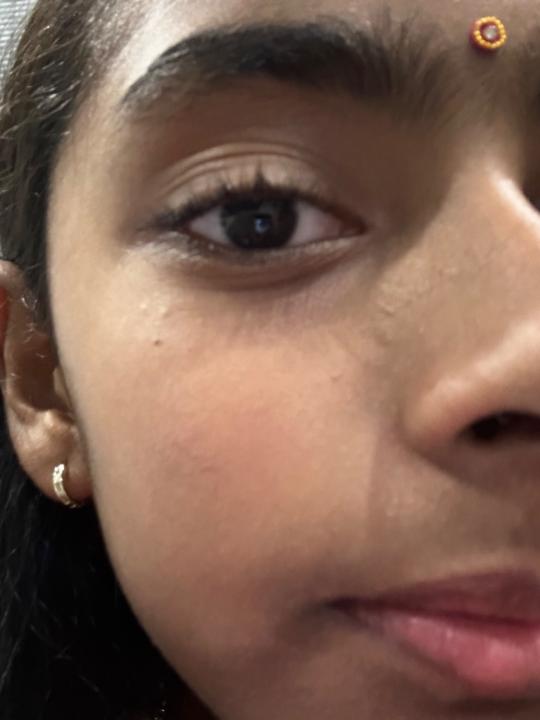 Netra M