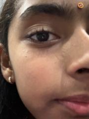 Netra M