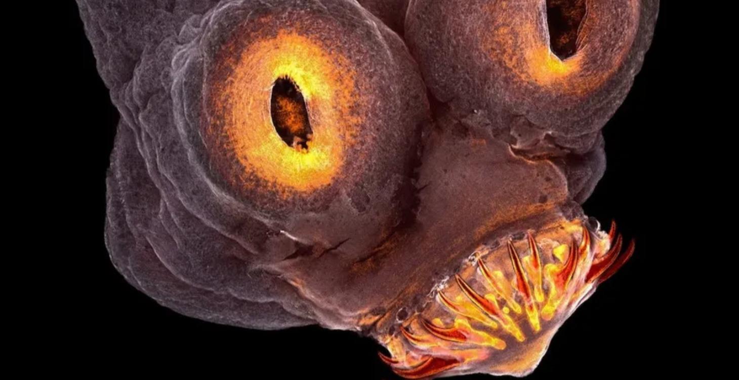 Parasite Free for a Free Mind