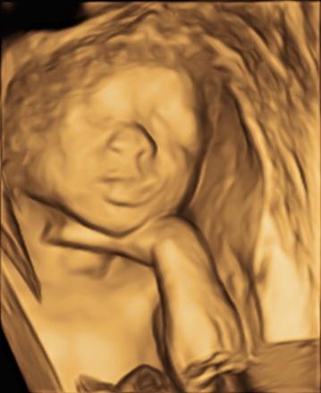 Clélia-janis Zandotti