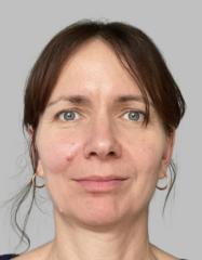Franziska Reinbothe