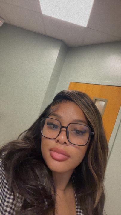Sherkera Allen