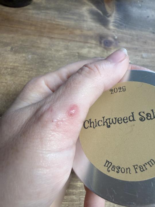Chickweed balm!