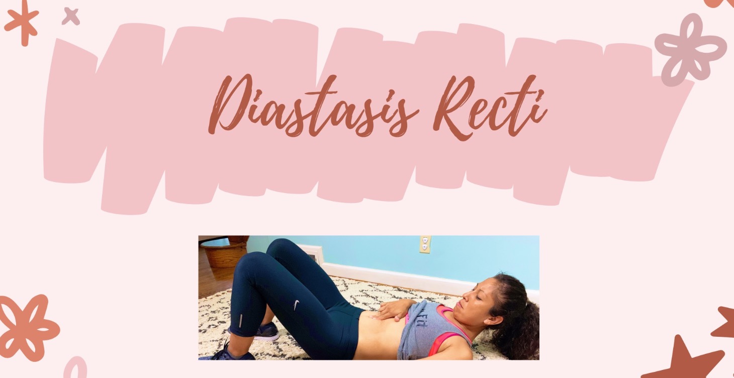 Diastasis Recti Education