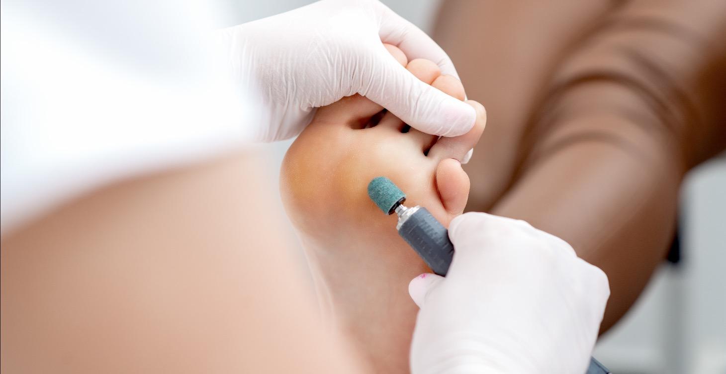 Самый Лучший Педикюр На Свете