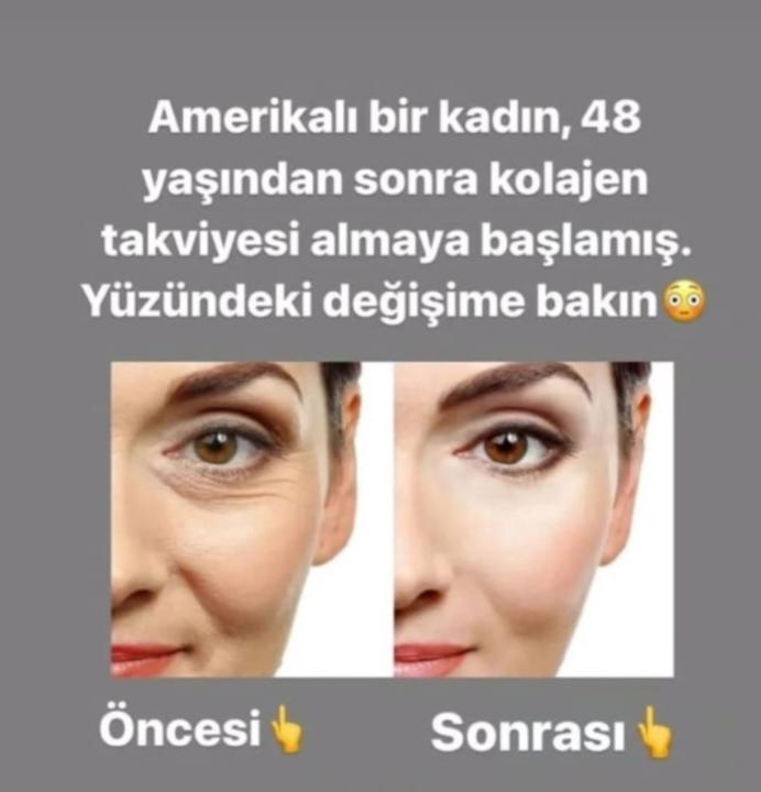 Dilek Parmaksız