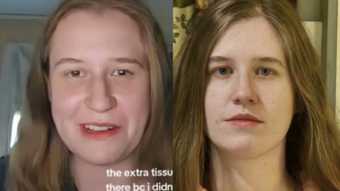 Facepulling gallery image