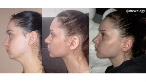 Facepulling gallery image