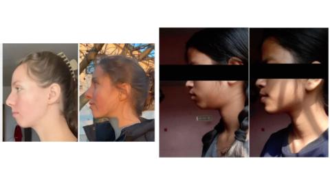 Facepulling gallery image