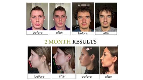 Facepulling gallery image