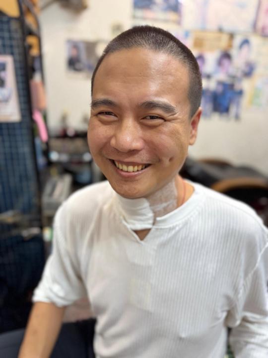醫生說，我不可能恢復到以前 100% 的狀態。