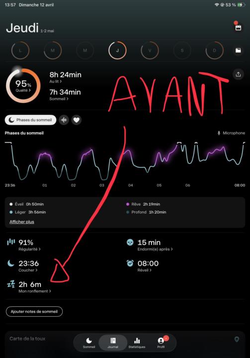 Comment j’ai atomisé mon apnée du sommeil ?