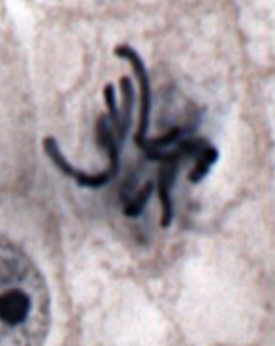 Mohammed Hussein