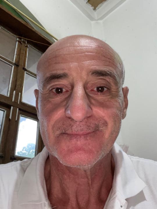 Alain Carpentier