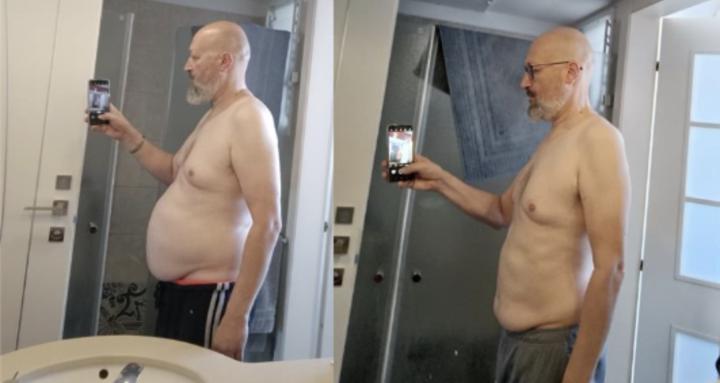 הורדת שומן בטני