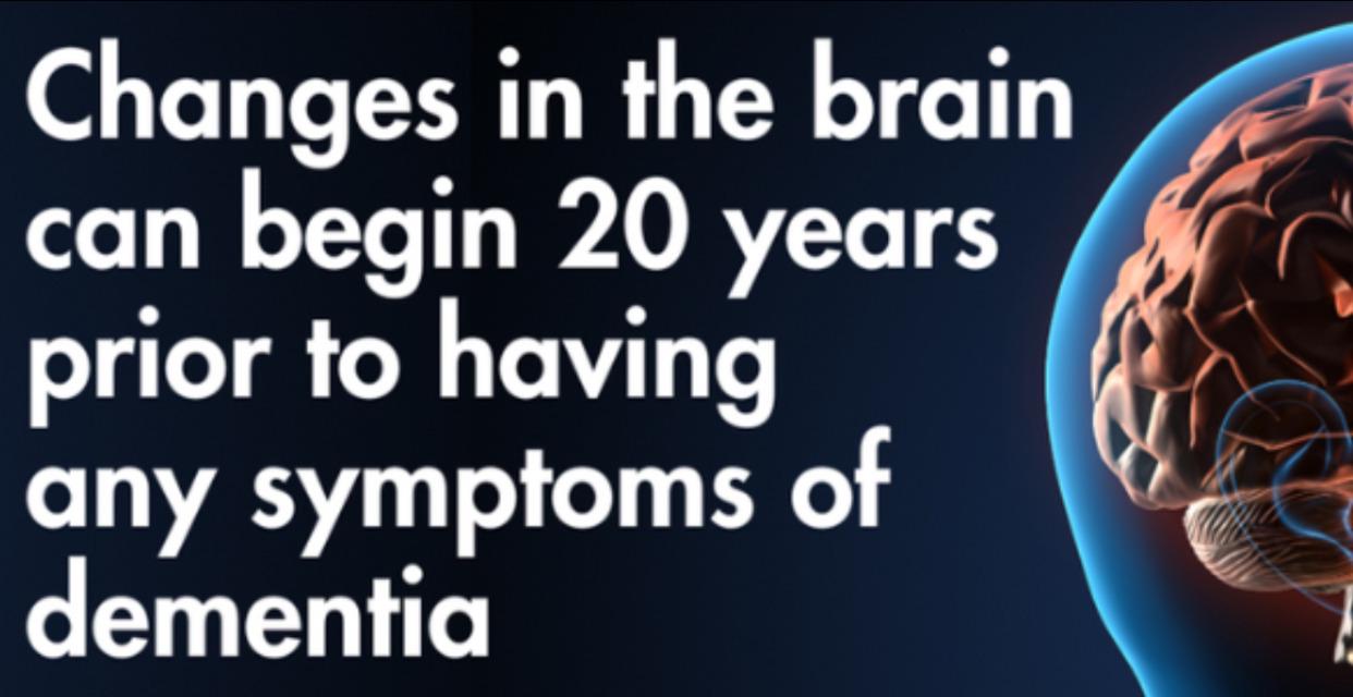 The Science Behind Alzheimer's LINX™: