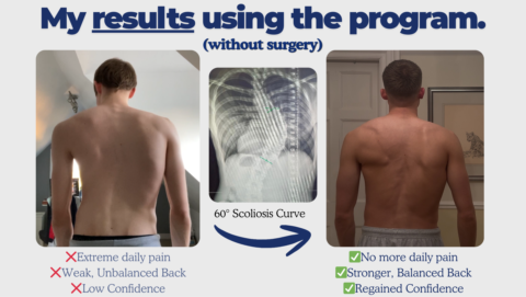Scoliosis Shark gallery image