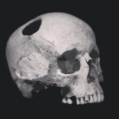 Ali Mundher Abd Ali Hussein