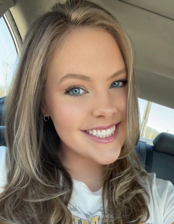 Lexi Oruglica